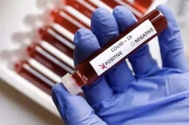 Nearly 15K new Covid cases in India  deaths cross 14K mark