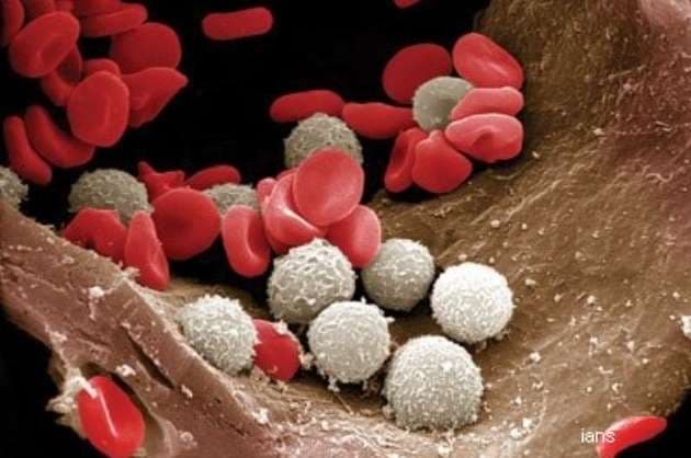 Covid 19 infection significantly changes our blood cells  Study