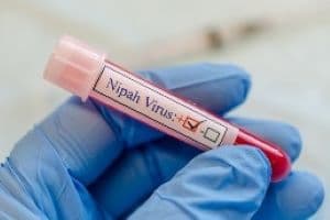 Teenaged Nipah Virus Patient Dies in Kerala, Government Issues Advisory