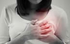 Women with Endometriosis May be at 35% Risk of Heart Attack, 20% Ischemic Stroke