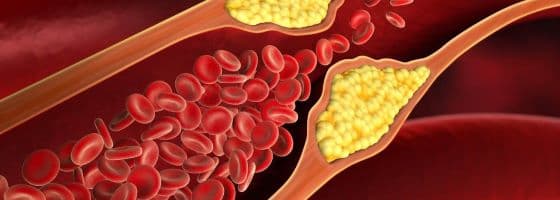 Indian Researchers Discover Cost-Effective Pathway to Cholesterol Management