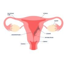 The Rise in Gynaecological Cancers in India, Younger Women Prone 