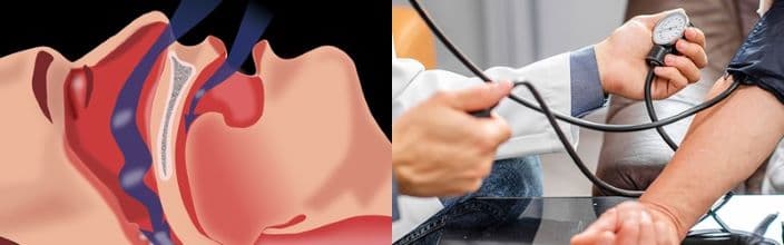 Research Finds Connection Between Snoring and High Blood Pressure