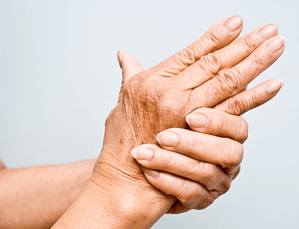 Chinese Scientists Develop Novel Hydrogel to Combat Rheumatoid Arthritis