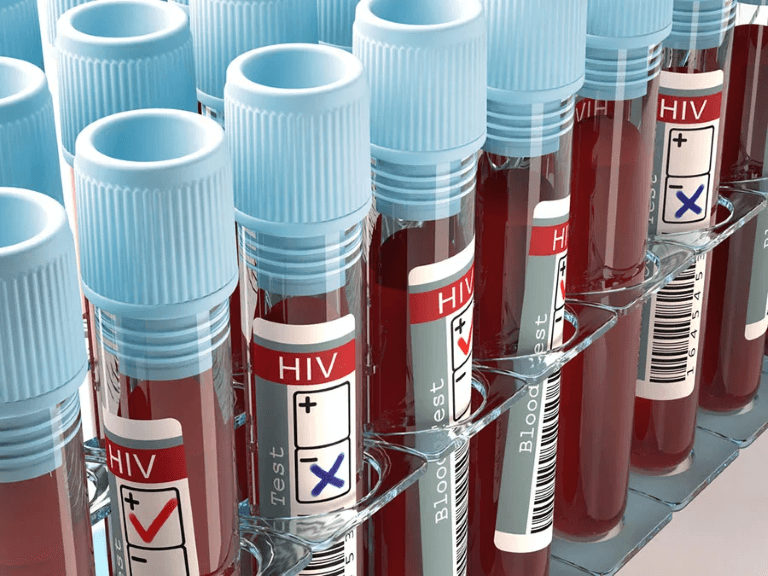 Global HIV Funding Cuts Can Cause Over 10 Mn Infections, 3 Mn Deaths by 2030: Lancet