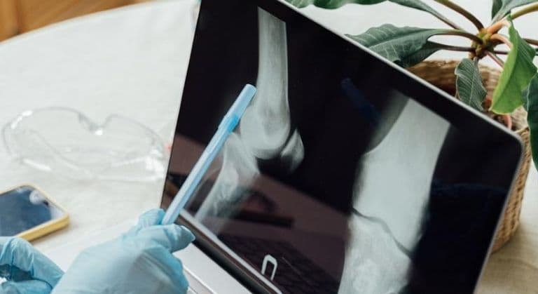 Indian Researchers Develop Diagnostic Device To Detect Early-Stage Bone Cancer