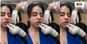 Uorfi Javed Shares Unfiltered Filler Dissolve Video of Herself With Hilarious Caption