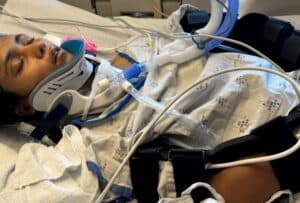 Indian Girl in Coma for Over a Month After San Jose Accident; Community Rallies Behind Family