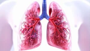 New Blood Test Enables Real-Time Lung Cancer Detection and Monitoring