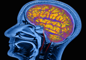 Sleep disorders linked to reduced gray matter in brain