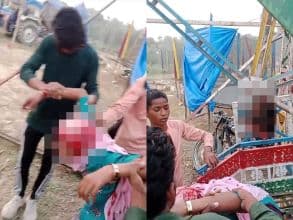 Teenage Girl’s Scalp Ripped Off as Hair Entangles in Swing Rod At a Fair in Uttar Pradesh