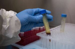 Another IAS officer tests positive for coronavirus in MP