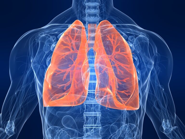 Why Are the Majority of Indians With Lung Cancer Nonsmokers?