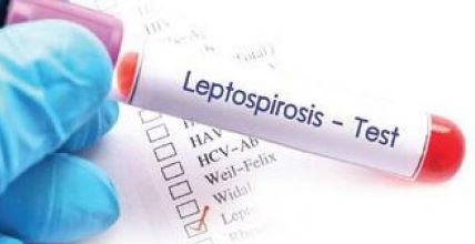 About Leptospirosis That Has Affected Punjab CM Bhagwant Mann