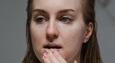 Scientists Develop World’s First 3D Cell Model To Treat Lip Injuries, Infections