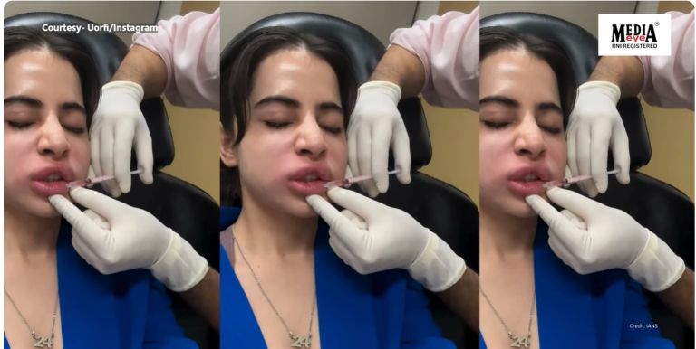 Uorfi Javed Shares Unfiltered Filler Dissolve Video of Herself With Hilarious Caption